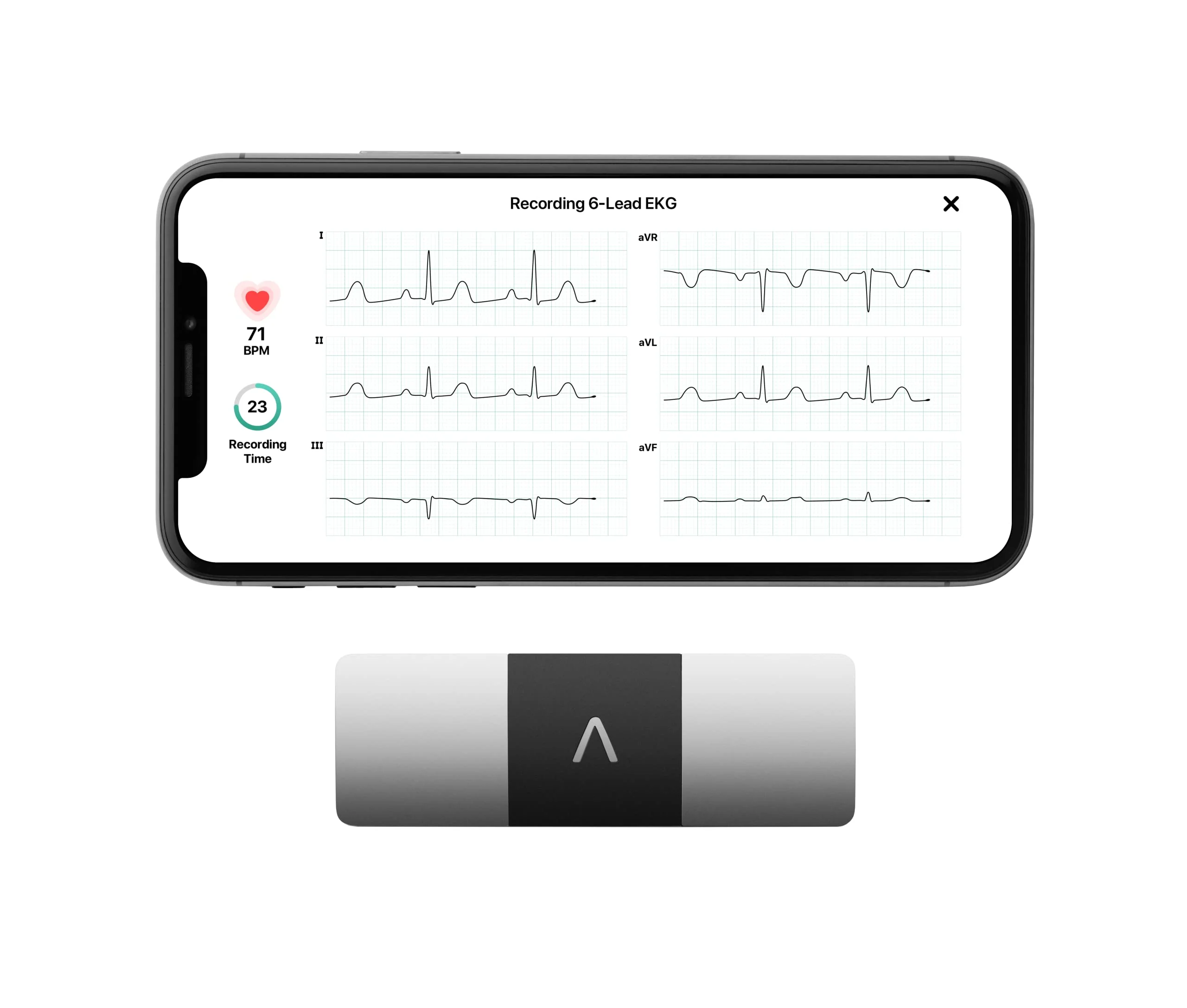 105AB627-2DC7-2435-E042-411675D160DB KardiaMobile 6L Personal EKG Monitor with Most Smartphones - Image 1